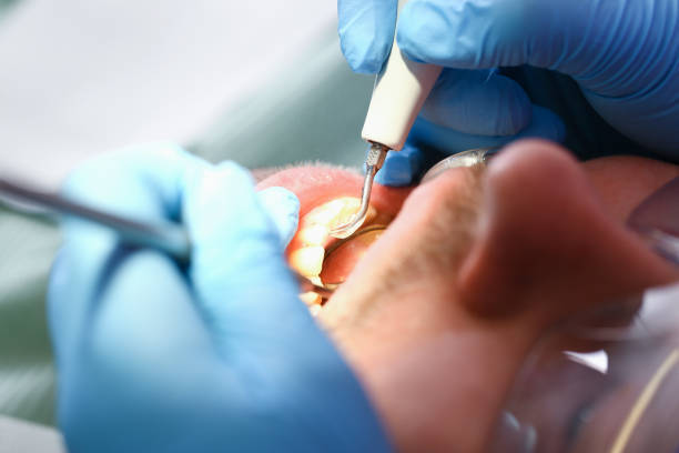 Best Emergency Gum Pain Relief  in Laguna Park, TX